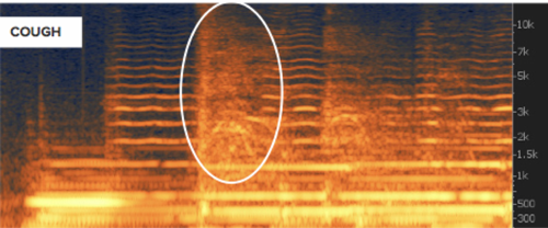 A cough shown on a spectrogram