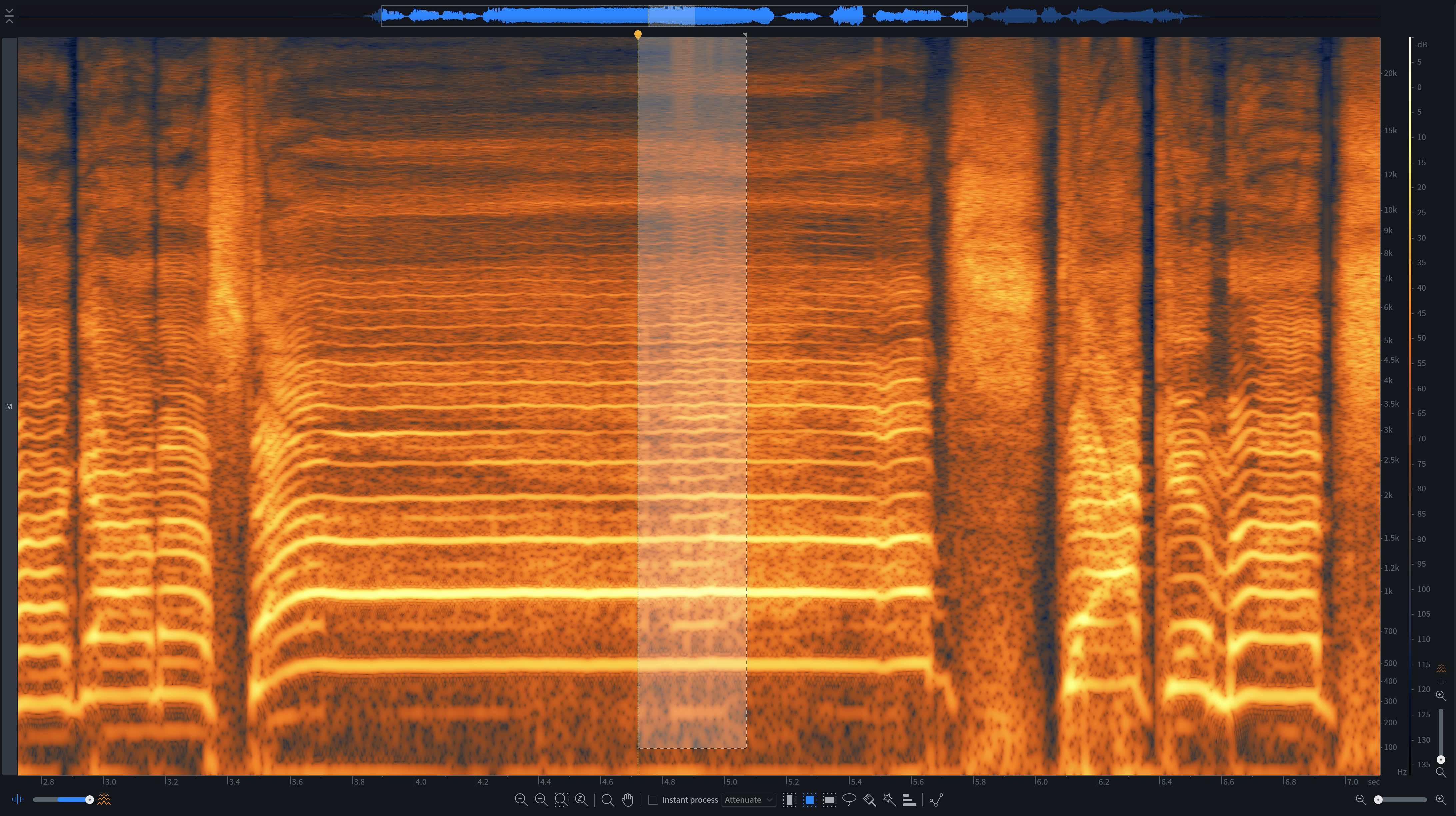 Vocal problems in RX Histogram
